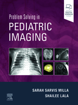 cover image of Problem Solving in Pediatric Imaging E-Book
